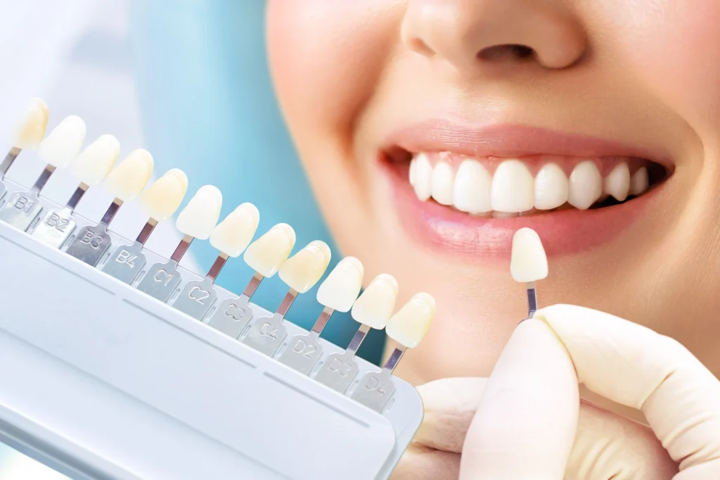 Tratamientos dentales estéticos